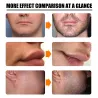 Beard / hair growth essence - spray - with needle roller massager - anti hair lossBeard