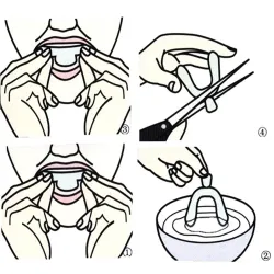 Silicone overnight mouthguard - teeth whitening - against grinding / clenching - 4 piecesTeeth Whitening