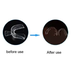 Silicone overnight mouthguard - teeth whitening - against grinding / clenching - 4 piecesTeeth Whitening