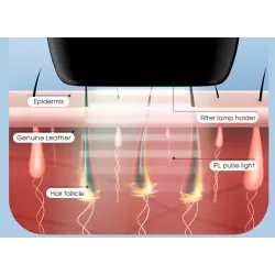 Épilateur laser - épilation permanente - IPL 900000 - 5 vitesses