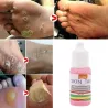 Ihomerkkien poisto - jalkasyyliä - lääketieteellistä nestettä - 10ml - 2 kpl