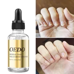 Fungal nail treatment - essential oilTreatment