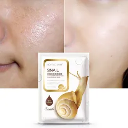 Snail essence gezichtsmasker - hydraterend - oliecontrole - acnebehandeling - 5 stuksHuid