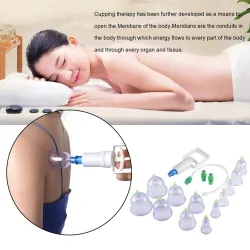 MasajeVentosas - masajeador anticelulítico - terapia de ventosas - medicina china - 12 piezas