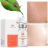 Snail extract face serum - moisturizing / whitening / anti wrinkle / anti acneSkin