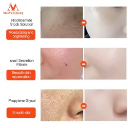 Snail extract face serum - moisturizing / whitening / anti wrinkle / anti acneSkin