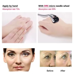 Derma roller - microagulhamento - agulha de titânio - para rosto/pescoço