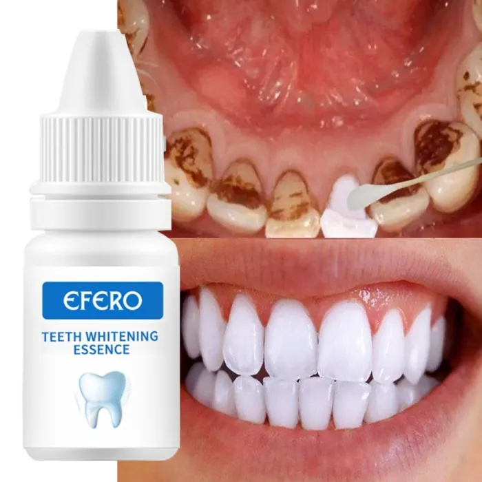 Serum wybielające zęby - żel - higiena jamy ustnej - pasta do zębówTeeth Whitening