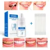 Tannblekingsserum - gel - munnhygiene - tannkrem