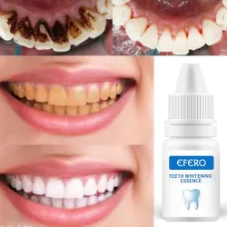 Teeth Whitening serum - gel - oral hygiene - toothpasteTeeth Whitening