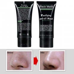 Blackhead & acne remover - nettoyage profonde épluchage masque visage 50 ml