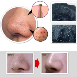 Blackhead & acne remover - djup rengöring rengöring peel off face mask 50 ml