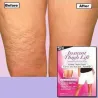 Instant laihtuminen - anti-cellulite reidet laittaa 8 kappaletta