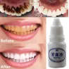 Hampaat valkaisuvesi 10 ml