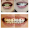 Tändblekningsvatten 10 ml