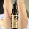 Lavendel massage olja - ärr borttagning - anti akne - hyaluronsyra serum