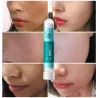 Acne behandling - blackhead remover - lysande mask med hyaluronsyra snigel essens 10 bitar