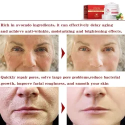 Ansiktslyftessensen - anti-aging - vitare - rynkborttagning ansikte grädde med hyaluronsyra