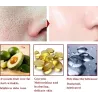 Ansiktslyftessensen - anti-aging - vitare - rynkborttagning ansikte grädde med hyaluronsyra