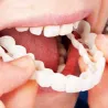 Silicone teeth cover - denture 2 pieces