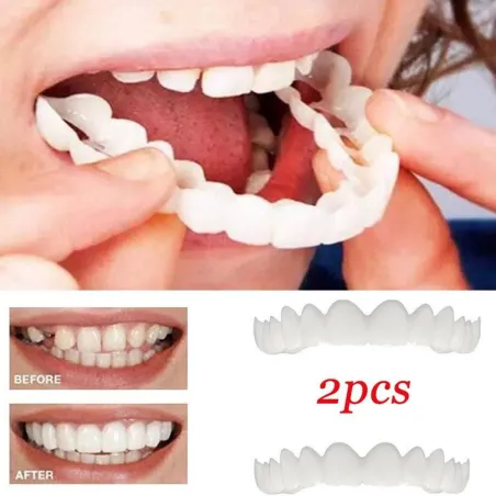 Silicone teeth cover - denture 2 pieces